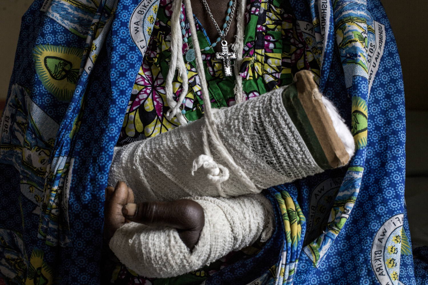 Alphonsime Mojetha (54) recovers in a hospital room on 2 March 2018 in Bunia. After an attack on her village she lost her two children and suffered severe machete wounds to the back of her head, her arms and her hands. She hid in the bush for two nights before making her way to Bunia to find help. ©John Wessels/MSF