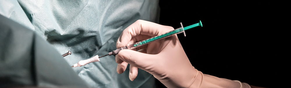 Embryo transfer – katheter – Brussels IVF