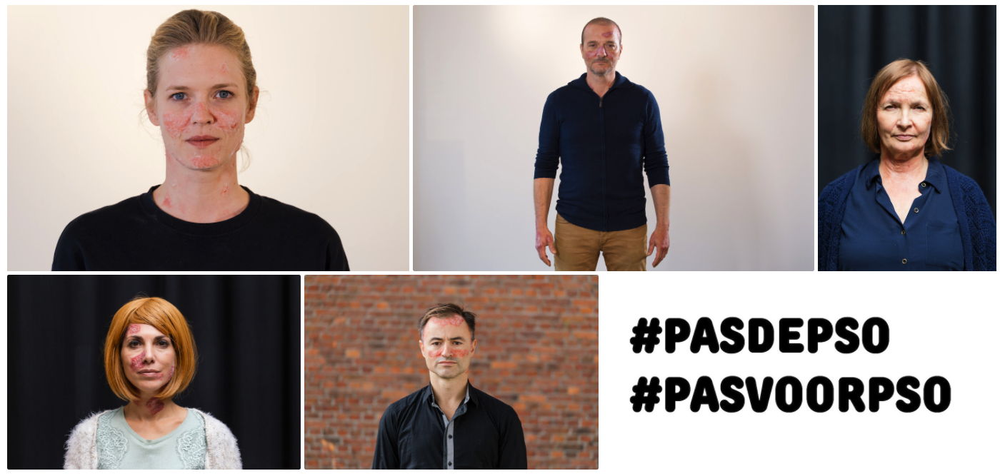 Lancement de la campagne #PasDePso : 5 Belges atteints de psoriasis défient 5 célébrités pour ne plus faire un pas de plus avec la maladie