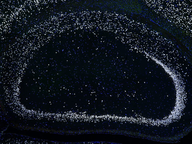 Can we protect nerve cells from dying? 