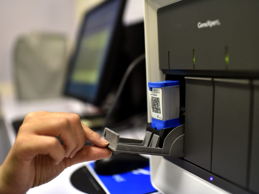 Tuberculosis: las empresas Cepheid y Danaher reducen el precio de las pruebas de diagnóstico