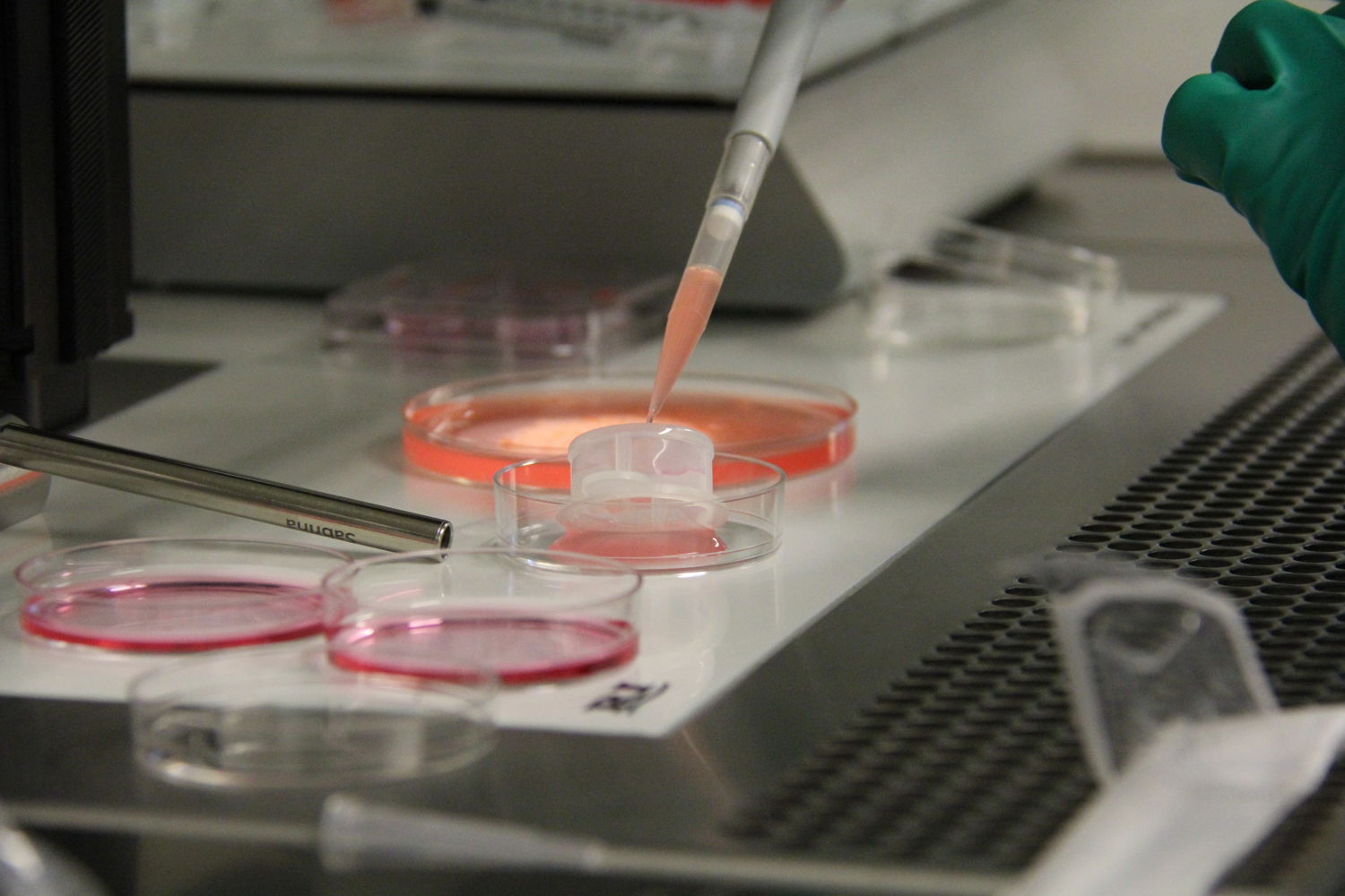 Bij in-vitro maturatie (IVM) in het UZ Brussel worden onrijpe eicellen in het laboratorium van het Centrum voor Reproductieve Geneeskunde tot rijping gebracht.