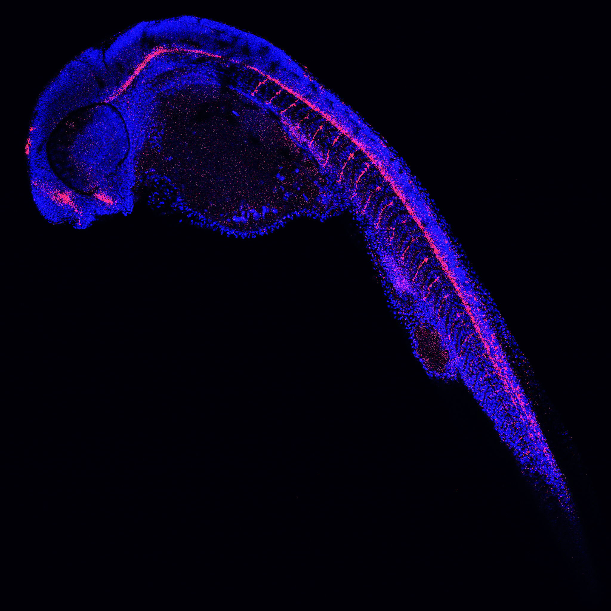Fluorescent neuronal staining in zebrafish embryo (nuclei in blue, axons in red)