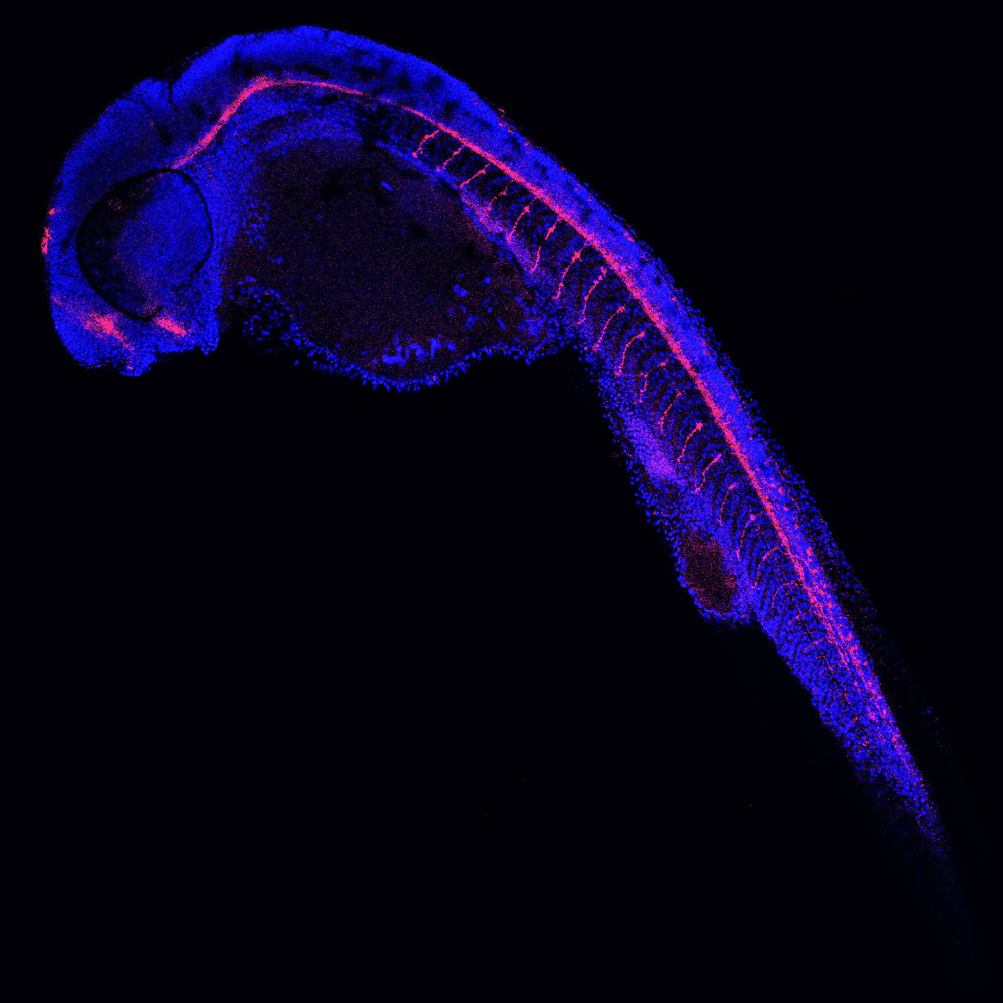 Een zebravissenembryo (celkernen in het blauw, axonen in het rood)