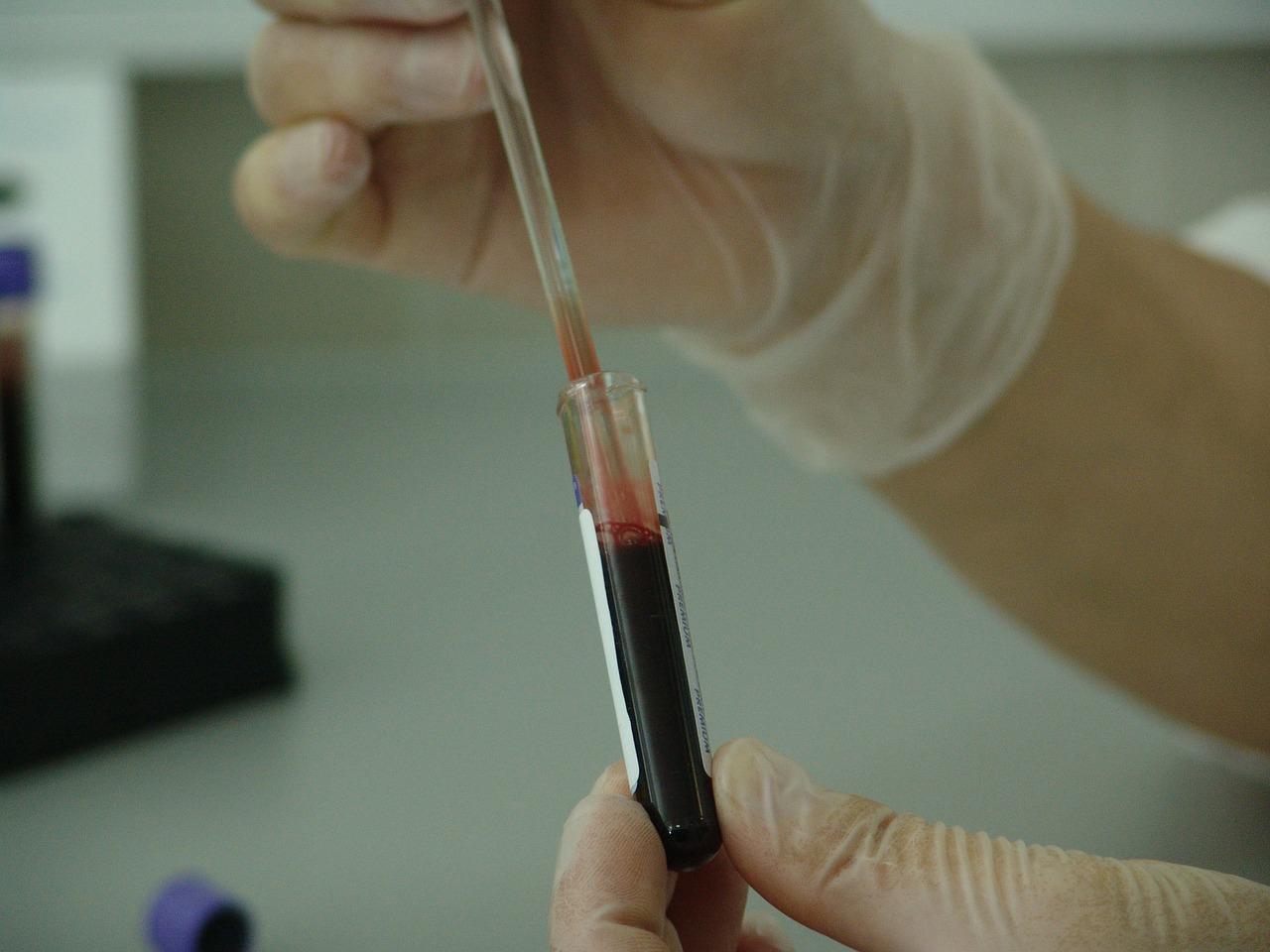 INTERREG CARES : la drépanocytose dépistée et traitée dès la naissance dans les pays de l’OECO