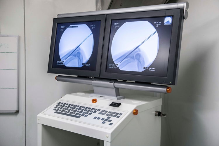 Pour la chirurgie orthopédique, nos équipes médicales utilisent des équipements de radiologie mobile (ici C-arm).
 
© Yann Libessart/MSF