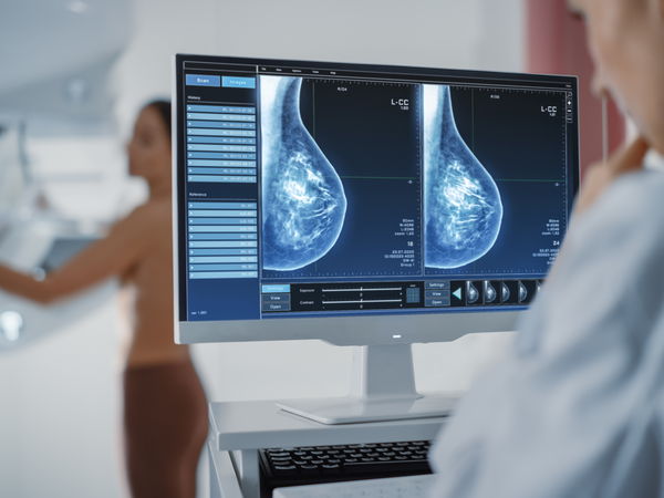 1 op de 4 vrouwen met agressieve borstkanker heeft mogelijk geen chemotherapie nodig