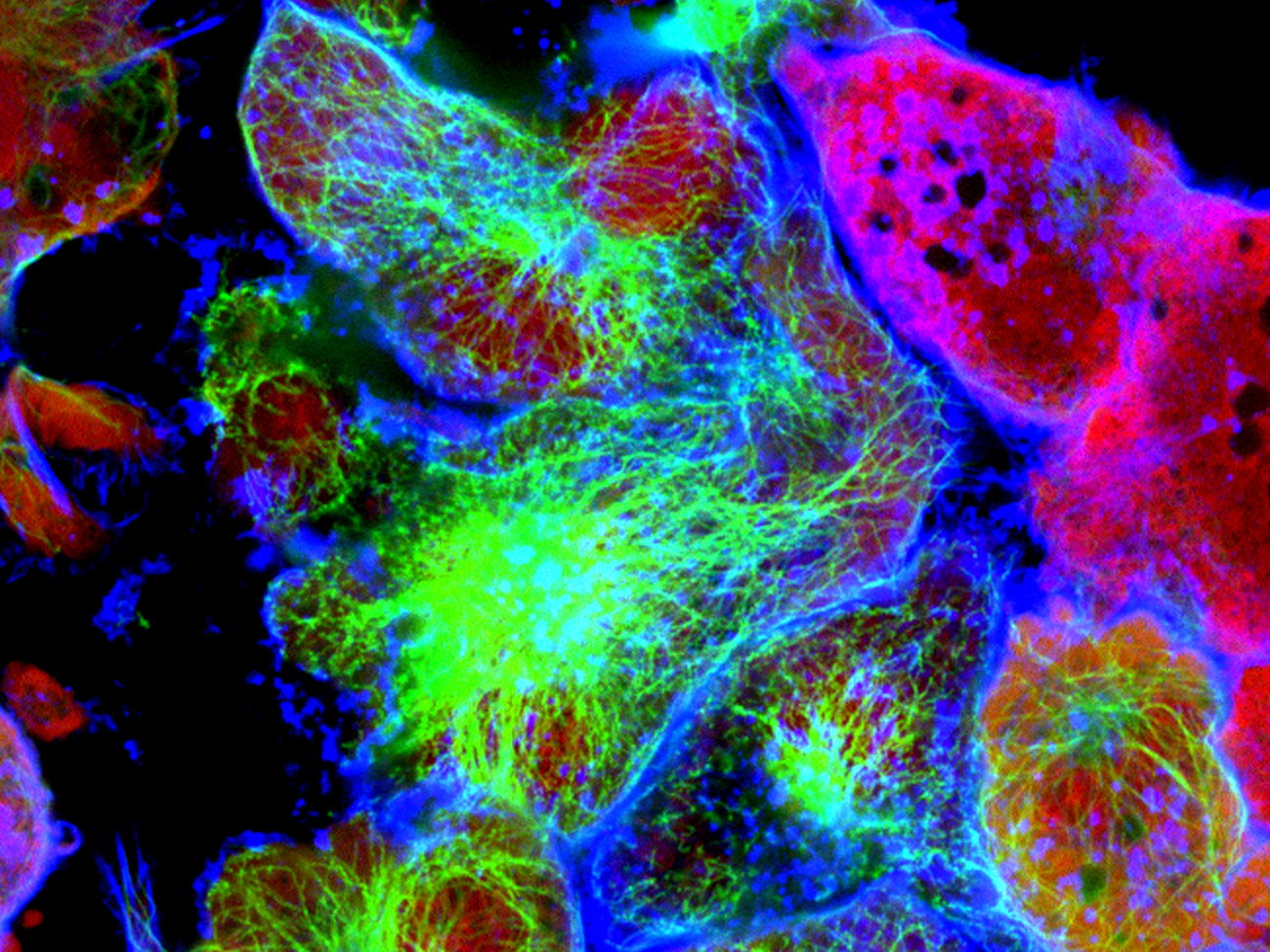 Researchers discover cause of immunosuppressive behavior of regulatory T cells in cancer