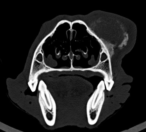 CT-scan
