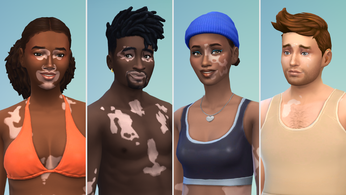 Les Sims 4 ajoute la caractéristique de peau Vitiligo en collaboration avec Winnie Harlow