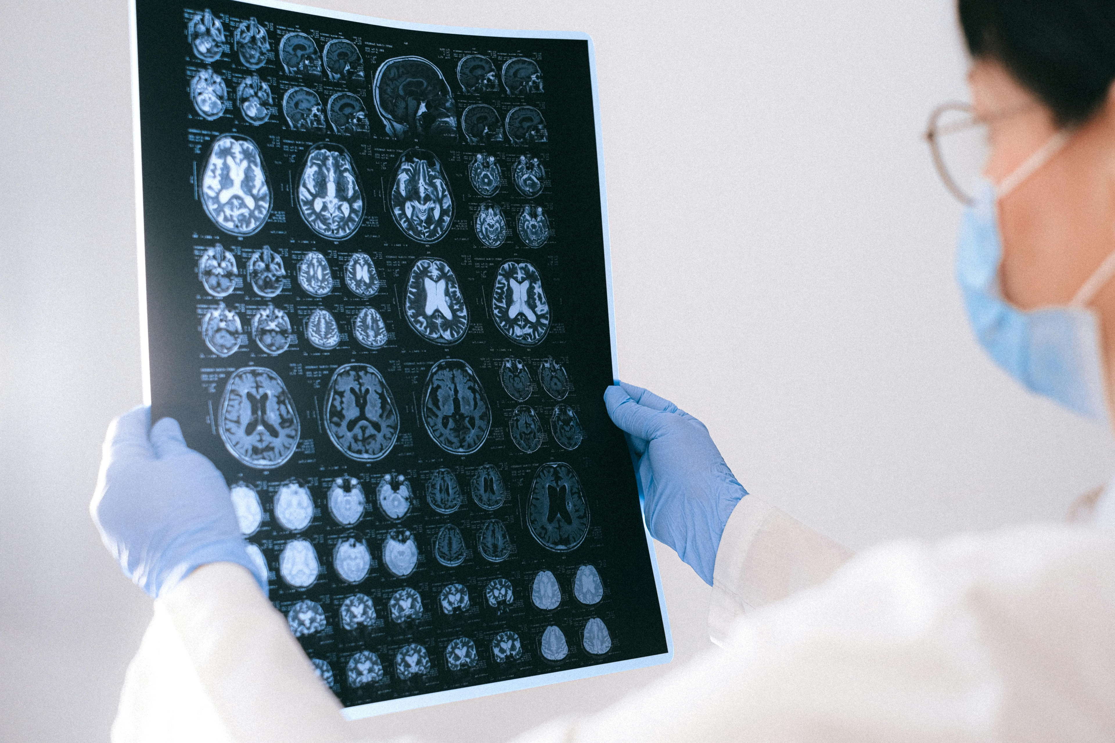 Expertenbrief pleit voor afzonderlijke beoordeling van nieuwe alzheimerbehandelingen in België