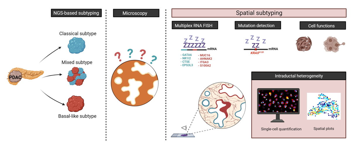 New RNA-staining technique permits mapping of pancreatic cancer tissues in human samples            © Ellis Michiels