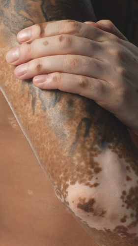 2024-03-13-ORD-BodyCare-Human-BodyScape-NoProduct-H-01-1x1 (1) 2024-03-13-ORD-BodyCare-Human-BodyScape-NoProduct-H-01-1x1 (1)