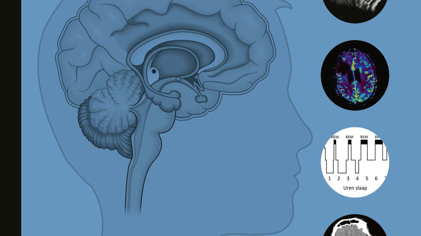VUB-onderzoekers slaan brug tussen neurologie en psychiatrie: nieuw academisch handboek herdefinieert medisch onderwijs