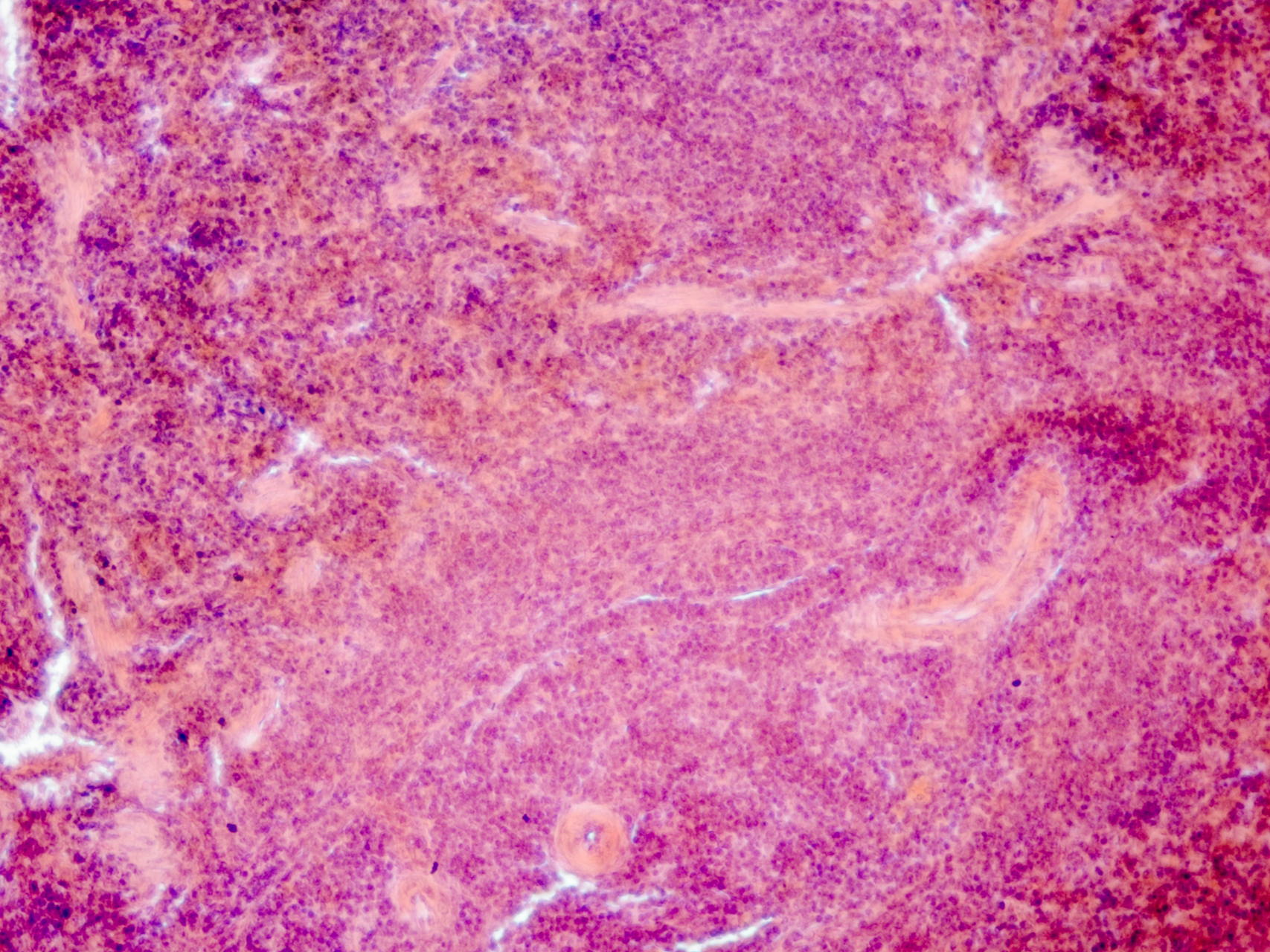 Onderzoekers identificeren een belangrijk metabolisch gen als doelwit voor verbeterde immunotherapie tegen kanker