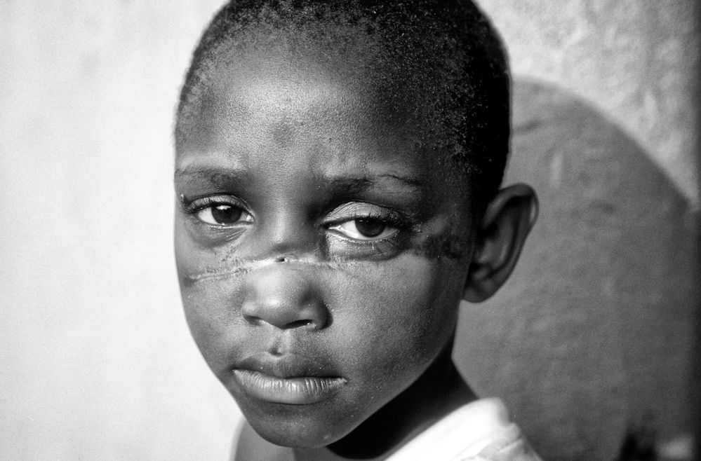 Claudine, SOS-Nothilfe-Kinderdorf in northern Rwanda, 1994. AKG7910229