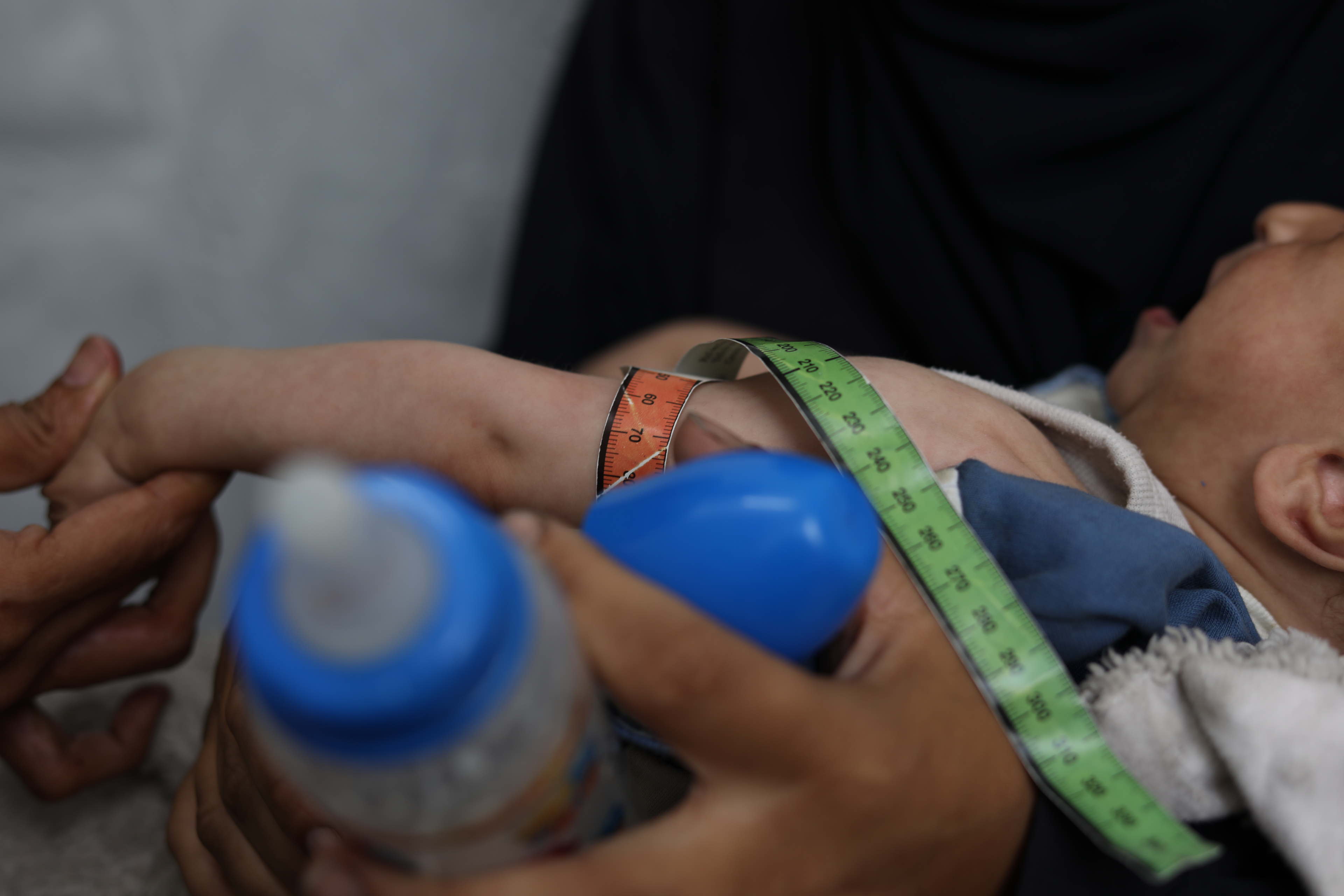 Gaza : des taux record de malnutrition aigüe dans deux centres MSF 