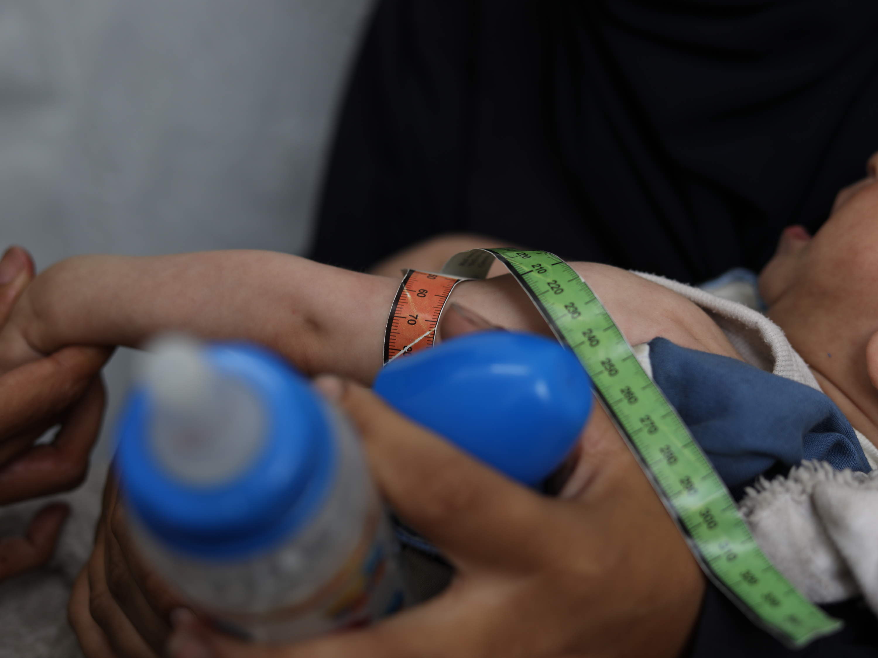 Gaza: ongeziene aantallen acute ondervoeding in twee AZG-faciliteiten