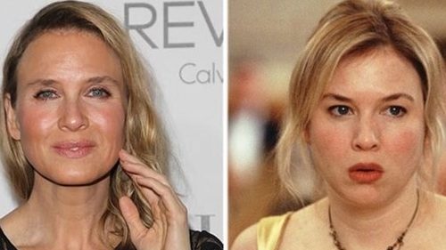 Koppen: botox (c) VRT