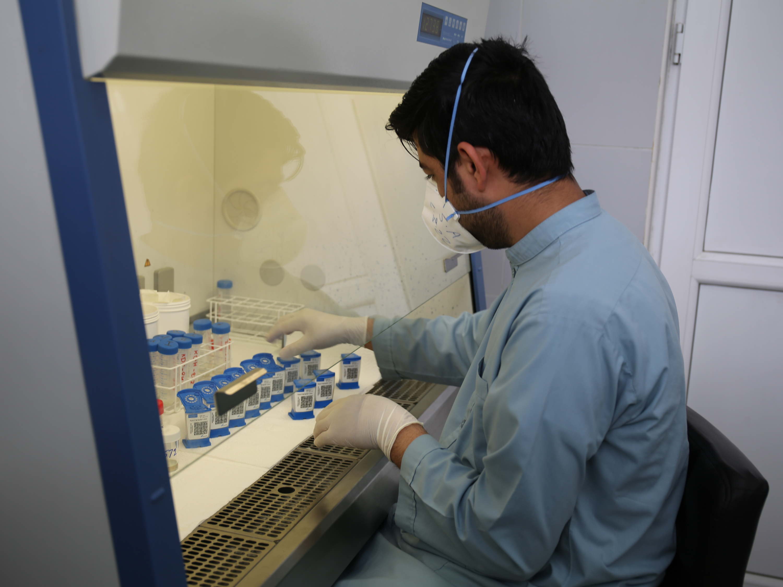 Día Mundial de la tuberculosis: Médicos Sin Fronteras pide que las pruebas diagnósticas y los tratamientos más avanzados para luchar contra la tuberculosis resistente a los medicamentos estén disponibles para todo el mundo