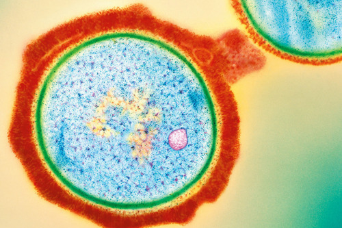 Staphylococcus infecties: onschadelijk of levensbedreigend?