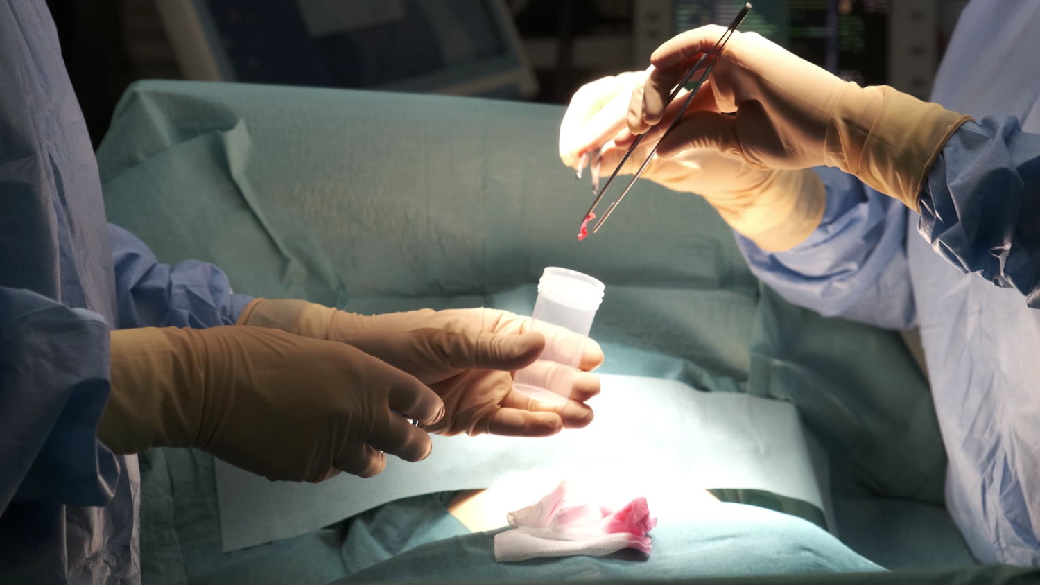 Tijdens een operatie wordt een weefselstaal genomen.