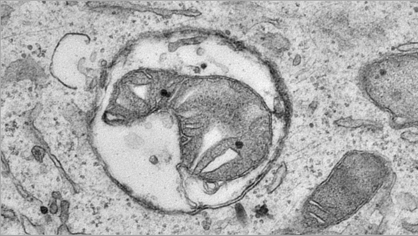 This electron microscopy image depicts a mitochondrial remnant in an autophagosome (a double-membrane vesicle that forms around cellular material that needs to be removed). It represents a key defect in the degradation of mitochondria as a major finding of the paper.