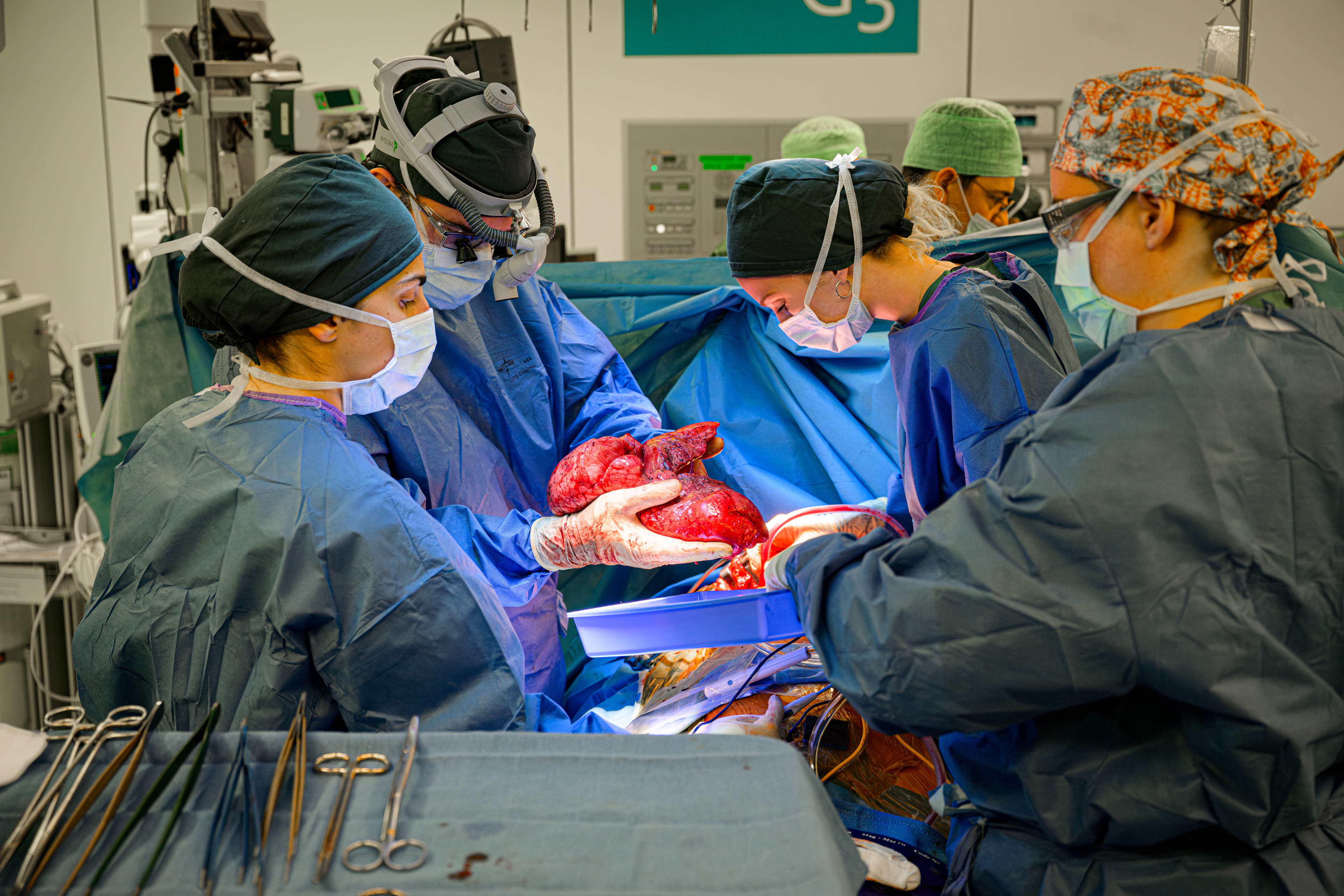 Belgische mijlpaal: UZ Leuven voert 1500ste longtransplantatie uit