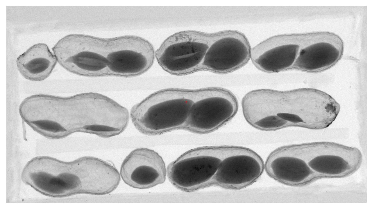 X-Ray image of peanuts