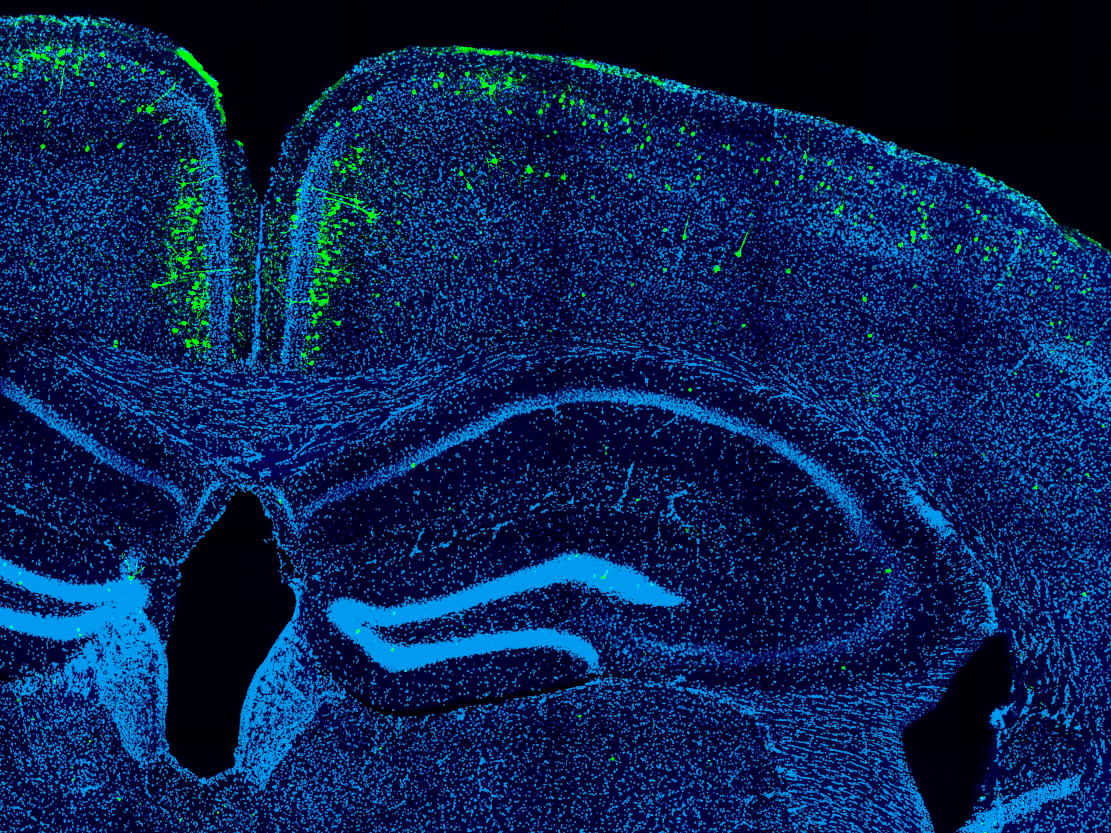 A new view on 300 million years of brain evolution