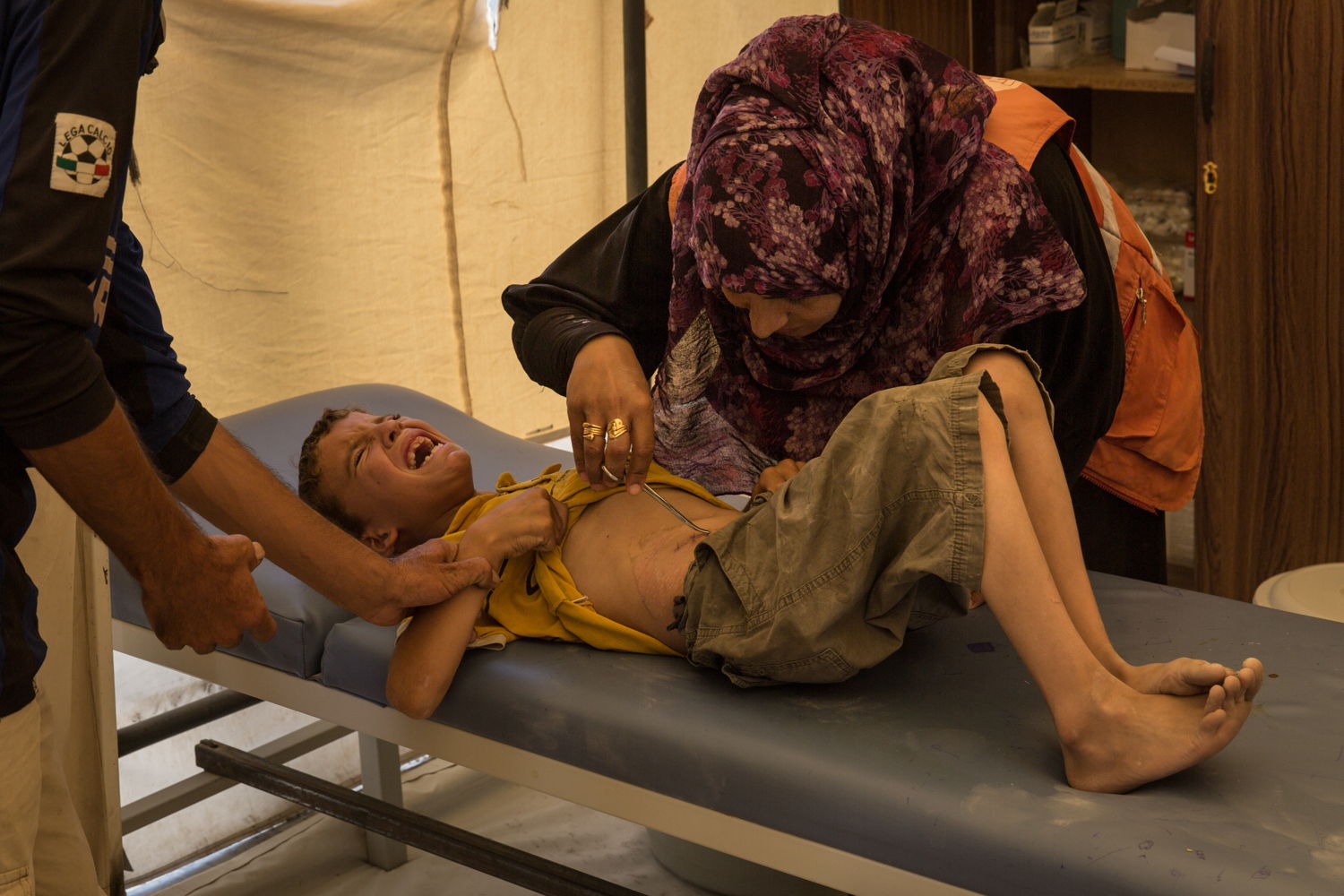 Juillet 2017 - Syrie - Rojava - Noord-Syrië, het vluchtelingenkamp van 'Aïn Issa / Kliniek AZG/ Een jonge Syriër uit Raqqa wordt behandeld voor zijn snijwonden.
Chris Hubby