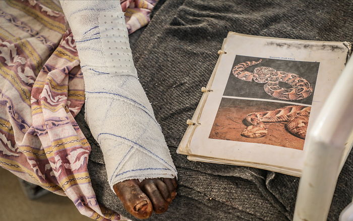 Arop Magut’s foot next to pictures of a puﬀ adder snake. Arop, 49, is from Abathok, South Sudan. He was bitten on the leg by a snake while harvesting sorghum in flooded fields. He arrived at MSF’s hospital in Agok 5 days after the bite and had multiple operations. Photo credit: MSF