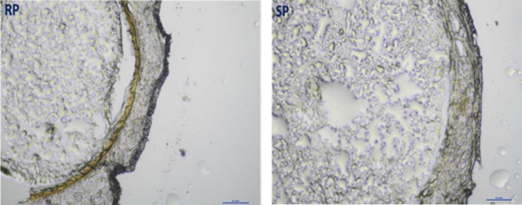 Fluorescent microscope images depicting secondary cell wall thickening in resistant groundnut variety (left) and susceptible variety (right)