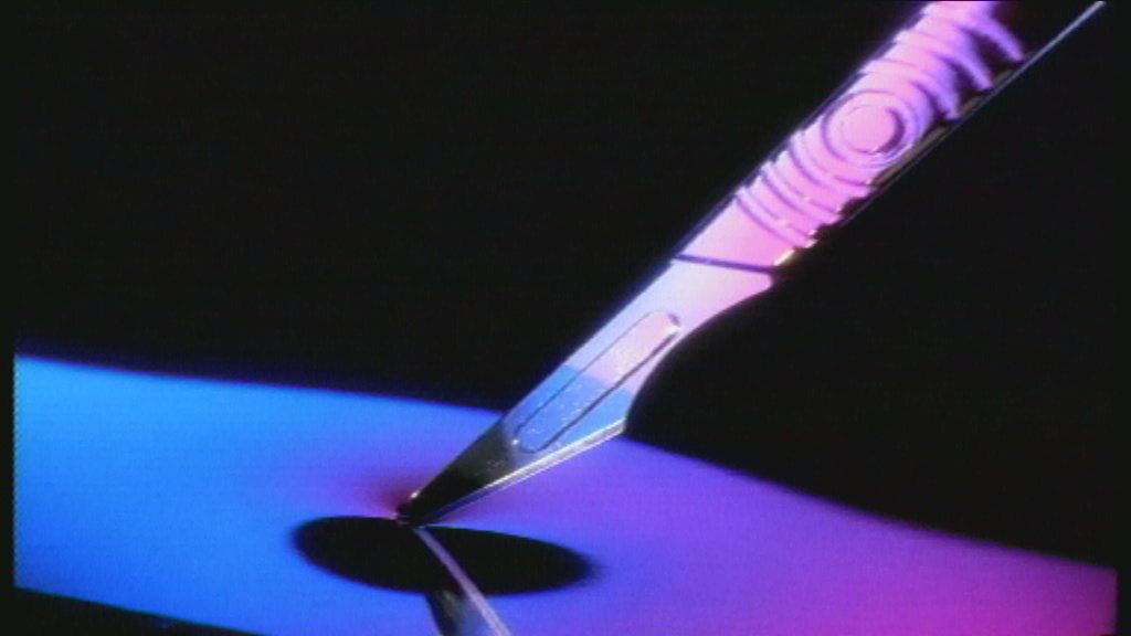 De scalpel uit de generiek in 1997 - (c) VRT