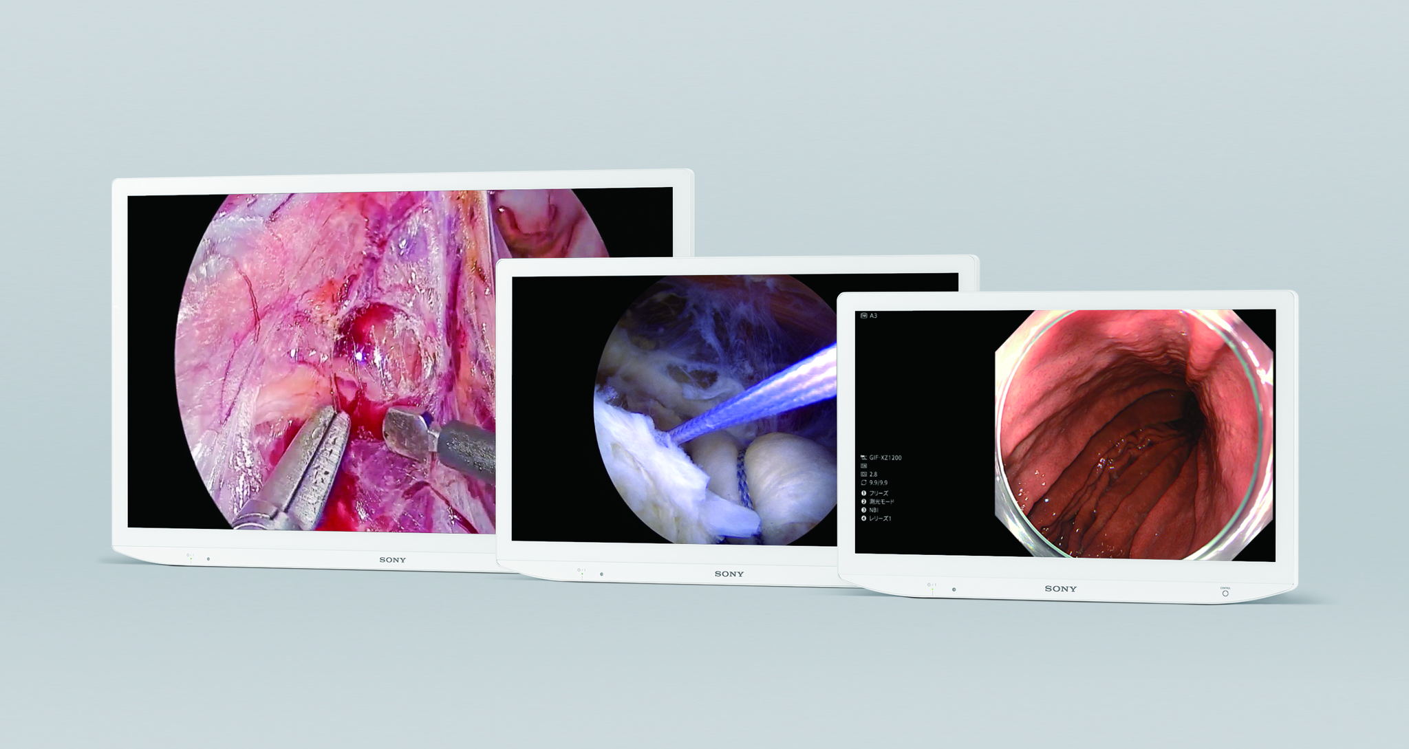 Introducing Sony's two new advanced medical monitors for