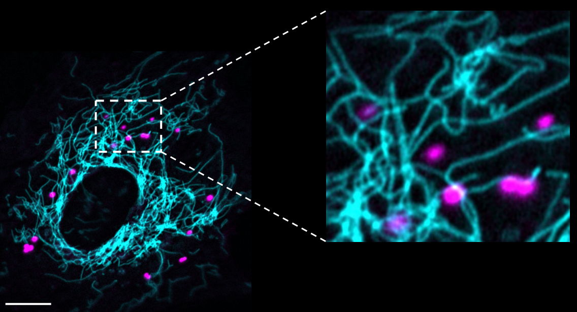 Het netwerk van mitochondriën (blauw) met lipid droplets (purper) van een lymfatische endotheelcel  (Meçe, Houbaert, et al. Nature Communications 2022)