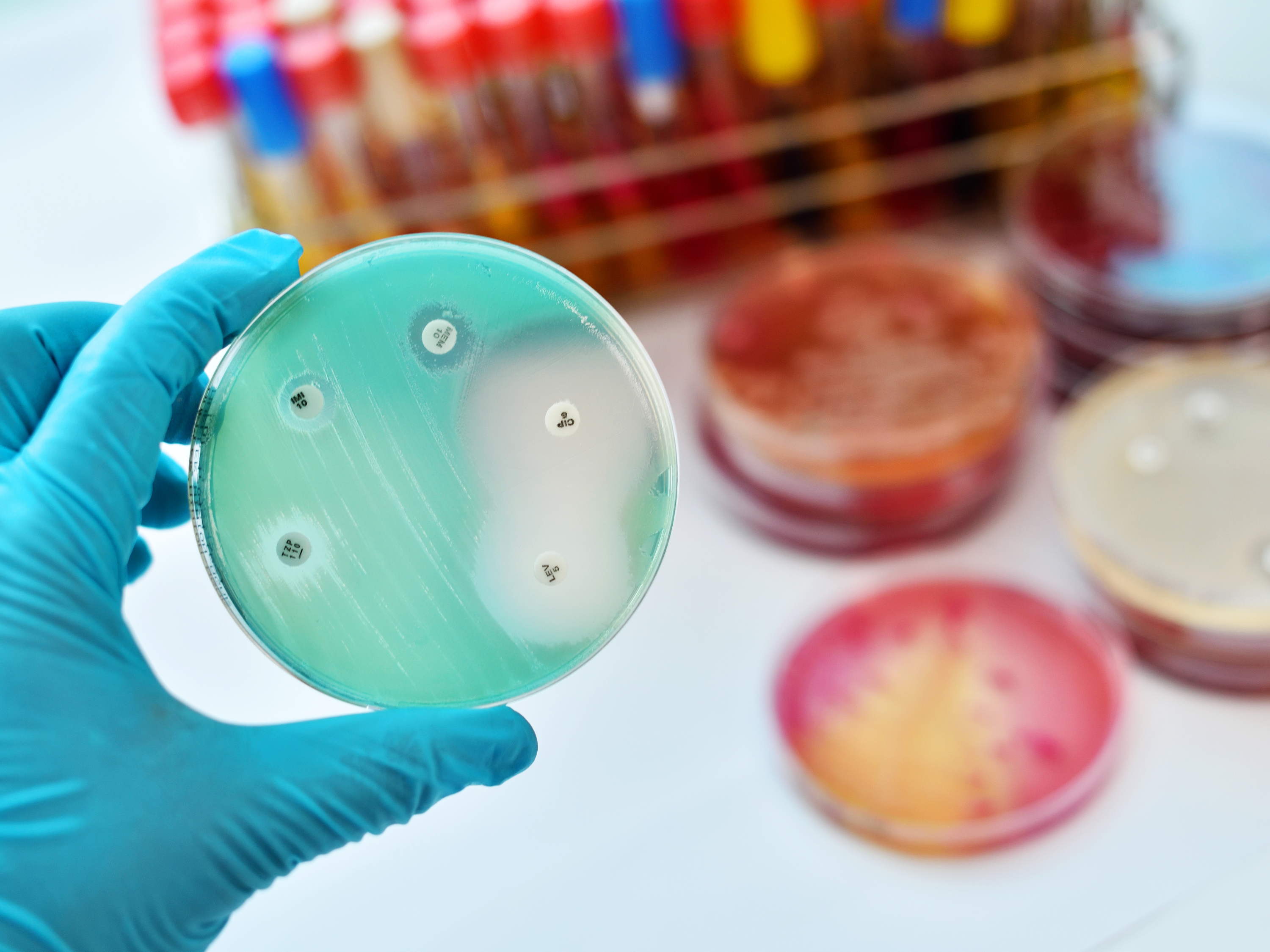 Slapende bacteriën wakker maken om antibioticaresistentie tegen te gaan