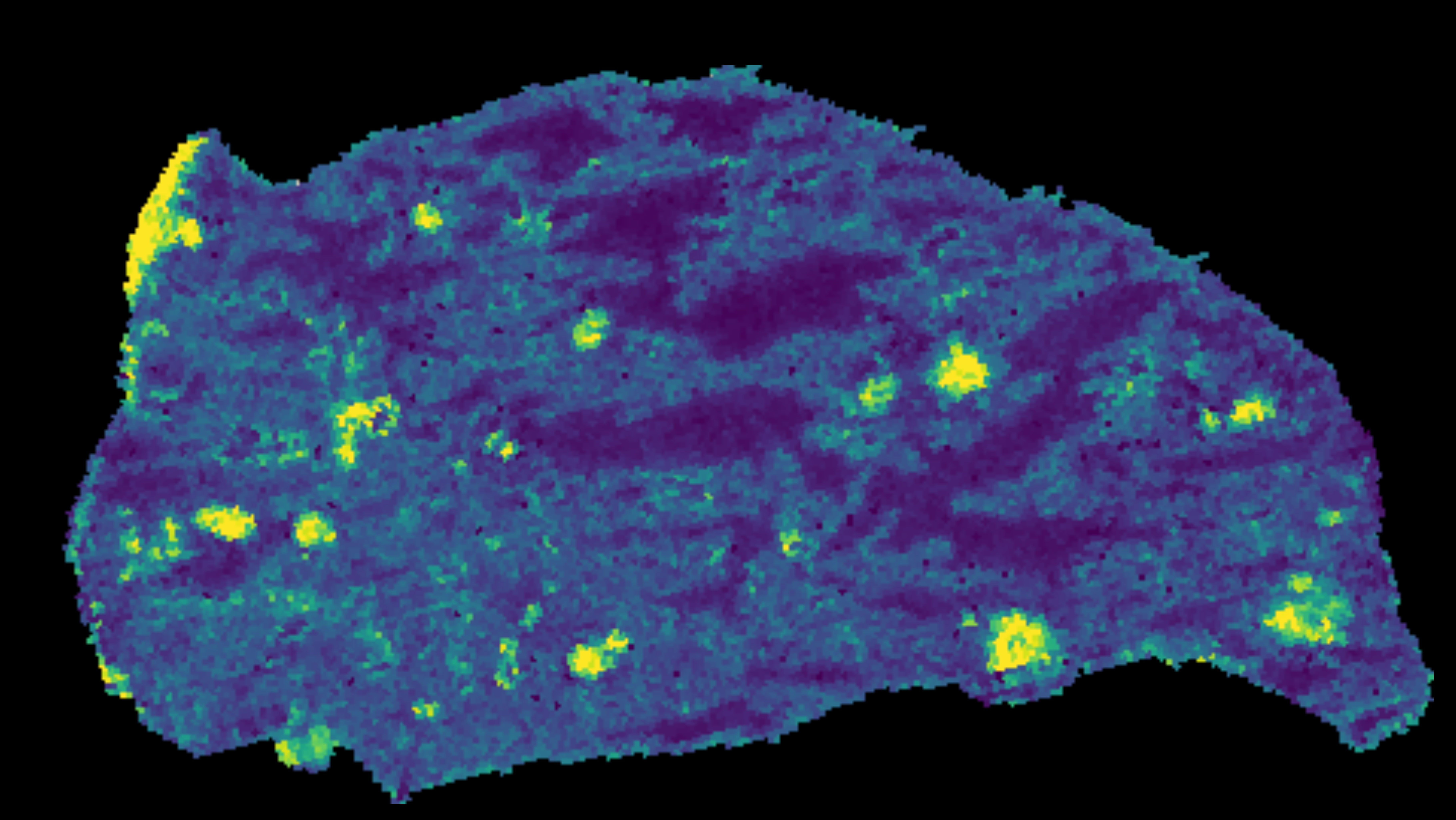 Lung tissue showing palmitate concentrations (yellow) where metastatic tumors are located.