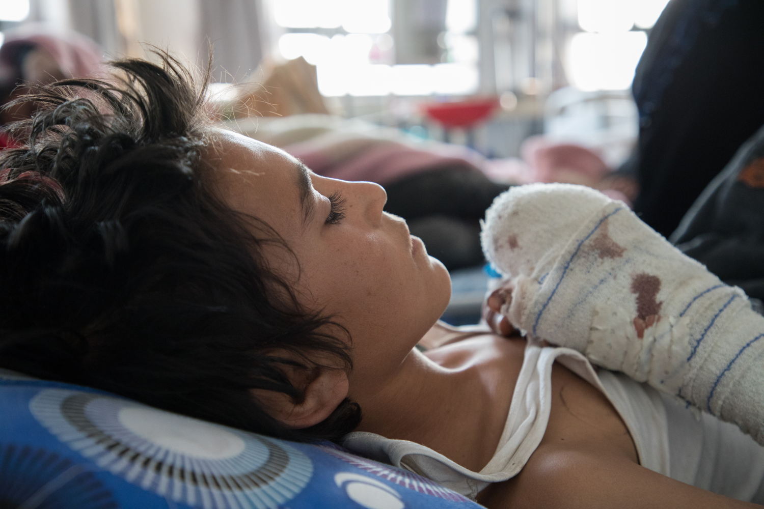 Ali (12) en zijn broers trokken met hun kudde schapen over een weiland toen er een explosief tot ontploffing kwam. Allen waren zwaargewond, één broer (van 5 jaar) overleefde het niet. © Louise Annaud/MSF