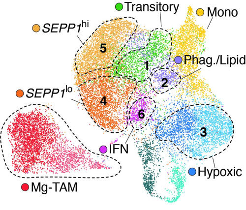VIB/VUB-team map immune cells in aggressive brain tumor