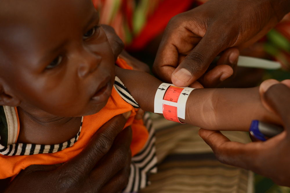 Jamila, 2 years old, undergoes a MUAC screening in the ATFC at the MSF clinic in Zamzam Camp, North Darfur, to assess her nutritional status. Zamzam camp near El-Fasher | 30/08/2024 | Photographer: Mohammed Jamal.
