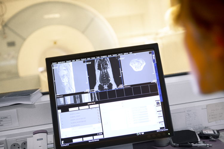 MRI scan 2