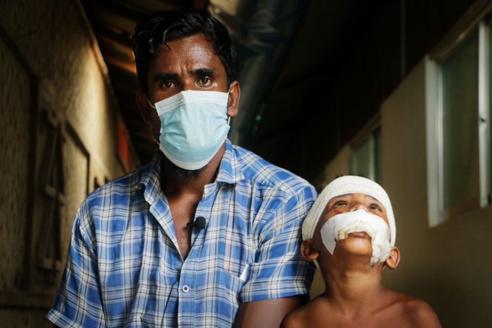 Abu Siddik komt uit de staat Rakhine in Myanmar. Hij woont nu in een vluchtelingenkamp in Cox's Bazar met zijn twee dochters, drie zonen en zijn vrouw. Op de foto bevindt hij zich in het AZG-ziekenhuis in Kutupalong met zijn vijfjarige zoon, Rashid Ullah, die herstellende is van een aantal verwondingen © Hasnat Sohan / AZG