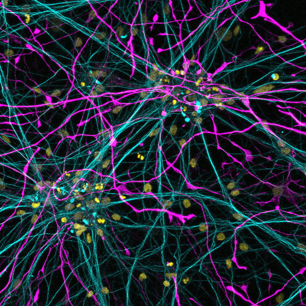 Humane motor neuronen (gekleurd met Neurofilament heavy chain (NEFH), in cyan) in co-cultuur met humane astrocyten (gekleurd met GFAP, in magenta), geimaged door Katarina Stoklund Dittlau.