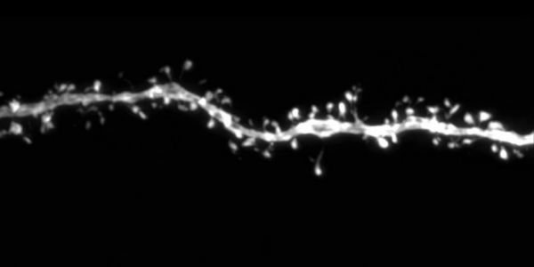 Dendrite - extension d'un neurone - d'un neurone cortical humain âgé de 12 mois, cultivé à partir de cellules souches humaines et transplanté dans le cortex cérébral d'une souris. L’expression de deux gènes spécifiques à l'humain, SRGAP2B et SRGAP2C, a été désactivée, ce qui a accéléré la maturation des synapses du neurone. Le nombre de petites protubérances sur la dendrite, appelées épines dendritiques, ressemble à ce que l'on observe généralement chez un enfant de cinq à dix ans. @ Baptiste Libé-Philippot 2024 ​