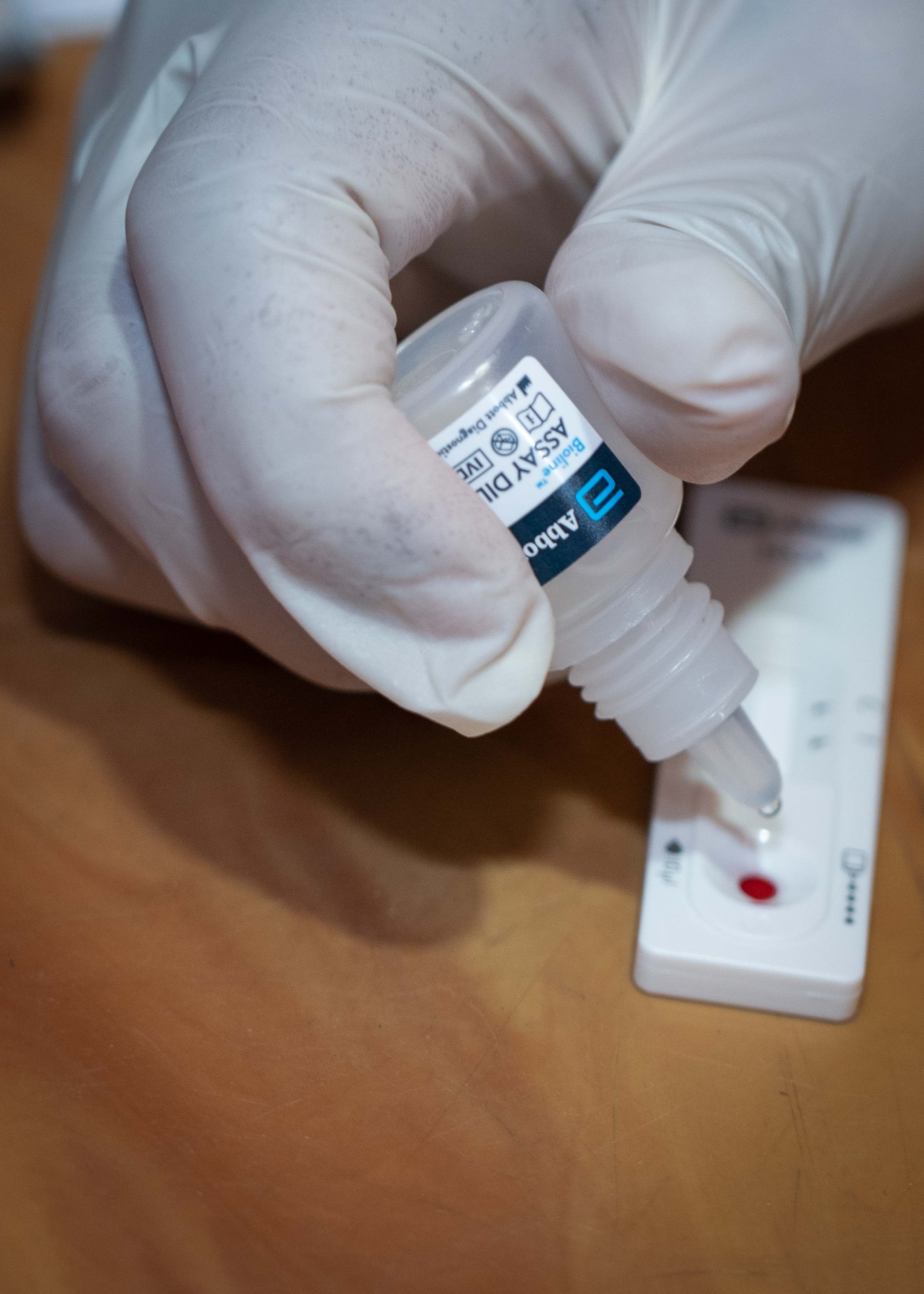 MSF staff at Hospital on the hill at world’s largest refugee camp is working with blood sample from a beneficiary to test. Here our team collects blood to test Hep C and also provides treatment. | Date taken: 26/05/2024 | Photographer: Abir Abdullah MSF staff at Hospital on the hill at world’s largest refugee camp is working with blood sample from a beneficiary to test. Here our team collects blood to test Hep C and also provides treatment. | Date taken: 26/05/2024 | Photographer: Abir Abdullah