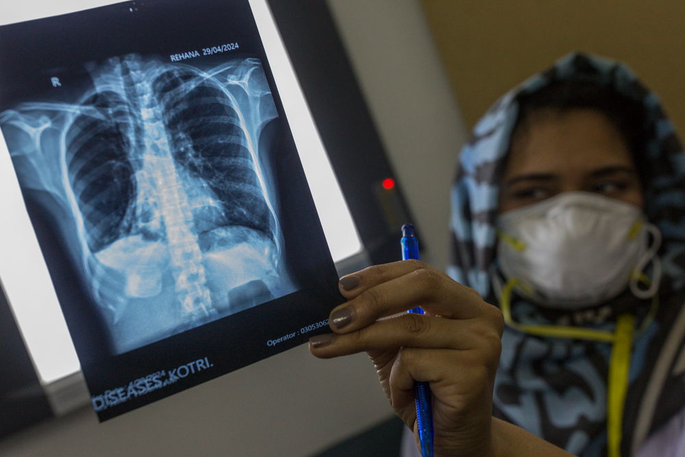 Dr. Muneeba Shaikh, a medical officer sees the results of X-ray of Rehana-28 year old, drug-resistant tuberculosis patient and participant of the endTB-Q trial at endTB clinical trial clinic in Kotri, Pakistan on Monday 29 April 2024. | Date taken: 29/04/2024 | Photographer: Asim Hafeez | Location: ​ Pakistan