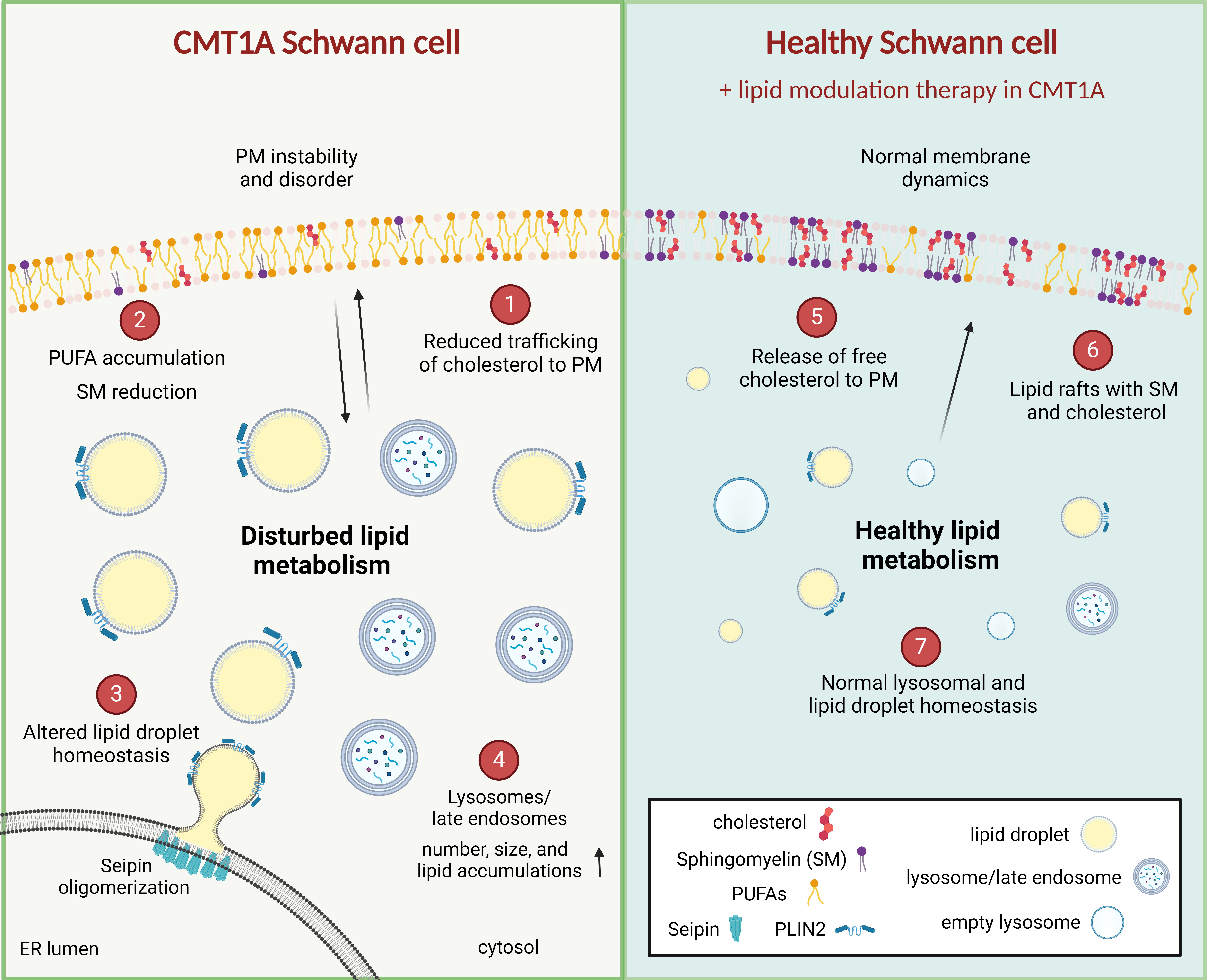 Perturbed lipid homeostasis during human CMT1A Schwann cell development. The figure was created with BioRender.com. Credit: Alessio Silva, Dr. Robert Prior, Dr. Tim Vangansewinkel.