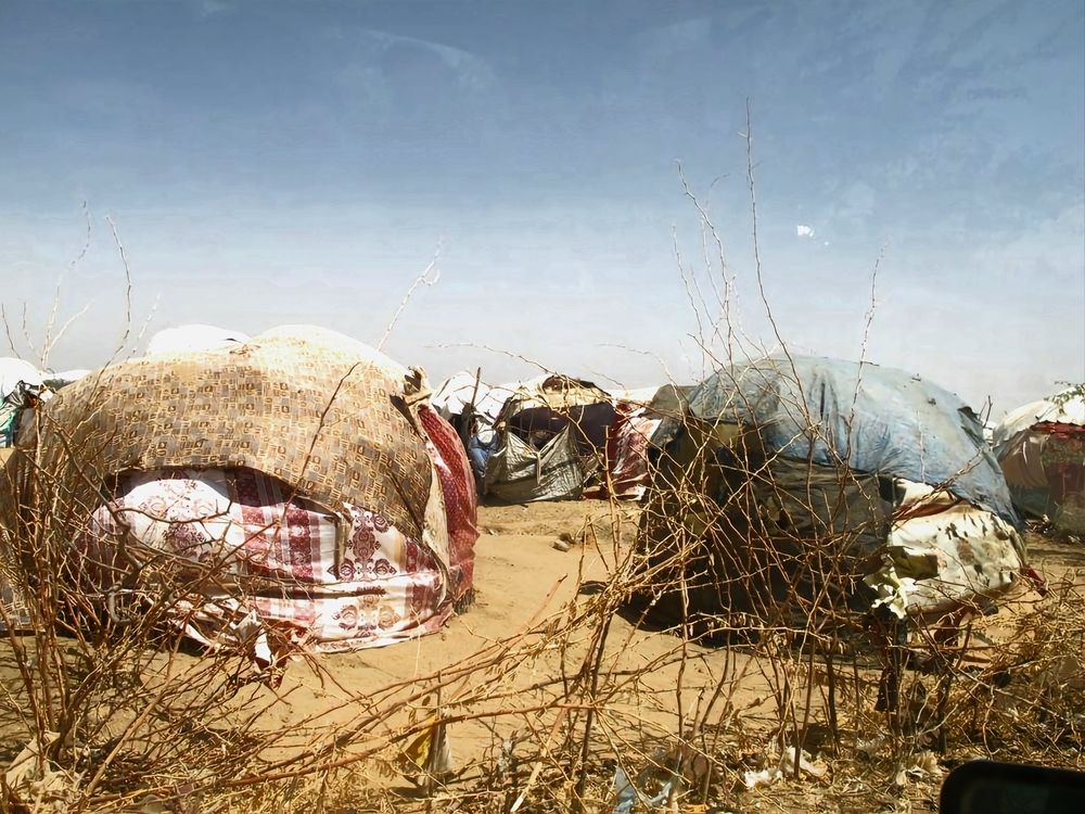 Kenia: récord de admisiones por desnutrición severa en el hospital de MSF en Dagahaley, Dadaab