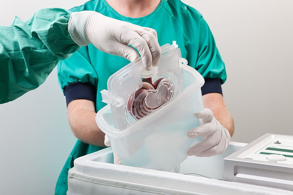 Koude bewaring van een donornier met een perfusiemachine. / © Organ Assist